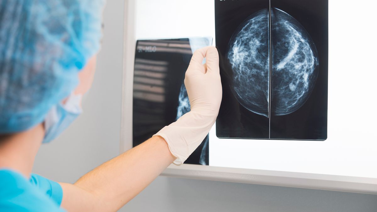 A person in scrubs and gloves holds an image of a mammogram above a lighted panel